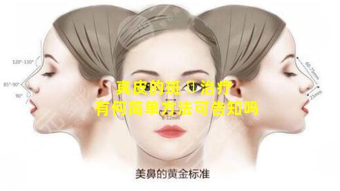 真皮的斑 ☘ 治疗有何简单方法可告知吗